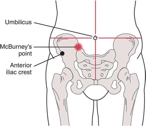 Mcburneys Point Anatomy