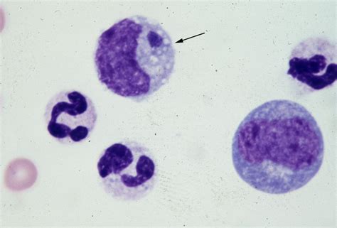 Vector-borne disease: Ehrlichia spp. infection – Bioguard