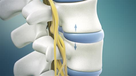 Microdiscectomy Spine Surgery’s Purpose of Procedure and Success Rate - Pain Management ...