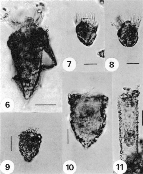 Chlorophyll “a” and phaeopigments variation at Boya 31 station ...