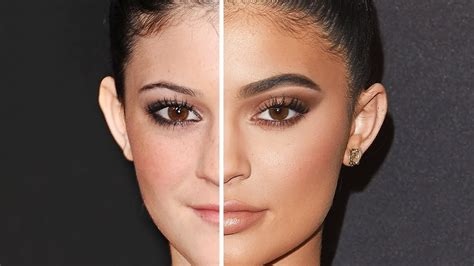 Kylie Jenner Plastic Surgery Before And After The Biggest Changes In Kylie Has Been Her Pout.