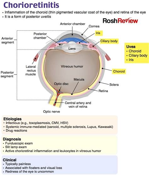 Chorioretinitis | Medical knowledge, Medical blogs, Medical laboratory ...