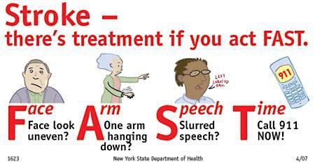 FAST mnemonic in stroke | IMJ Neurology | Pinterest