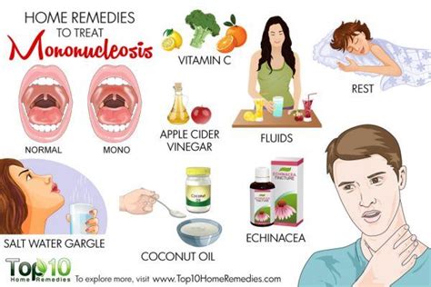 Home Remedies to Treat Mononucleosis | Top 10 Home Remedies