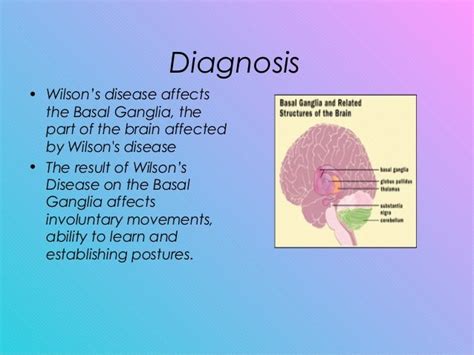 Wilson’s disease