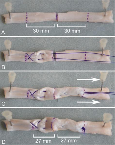 Additional steps for suture pretensioning. a Tendon purchase of 30 mm... | Download Scientific ...