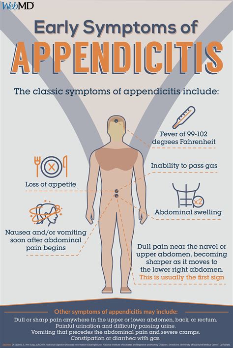 WebMD - Appendicitis is almost always a medical emergency...