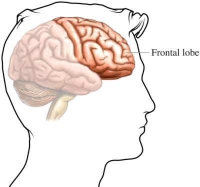 The Frontal Lobe | Dambreaker