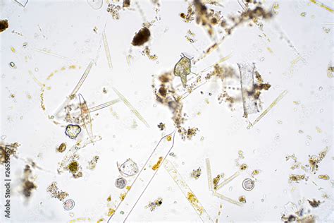 Marine aquatic plankton under microscope view. Stock Photo | Adobe Stock