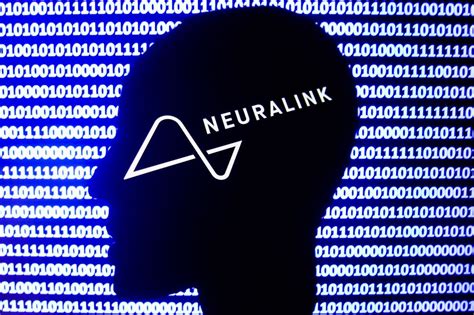 Neuralink Is Hiring Clinical Trial Team as It Nears First Human Test | Observer