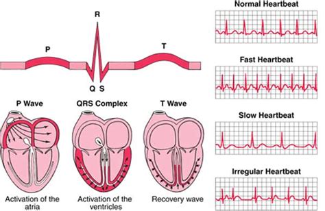 BASIC EKG INTERPRETATION | BRILLIANT EDUCATION