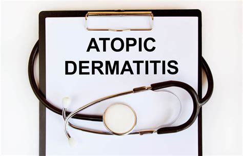 The American Academy of Dermatology Publishes Updated Guidelines for ...