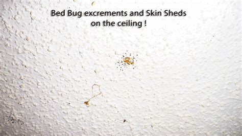 The Worst Case of Bed Bug Infestation - Quest Pest