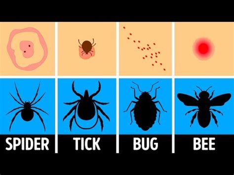 What do pincher bug bites look like? [Updated Guide]