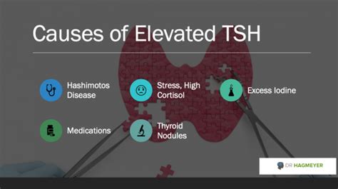 5 Causes of Your High TSH in Woman (Hypothyroidism)- That No One Is Talking About | Dr. Hagmeyer