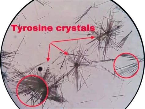 Crystal Identification, Tyrosine, Sediment, Working Woman, Biology ...