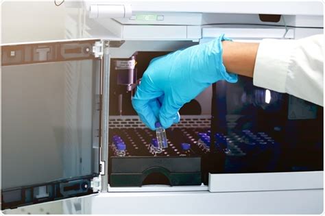 Applications of Fast Protein Liquid Chromatography (FPLC)