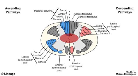 Spinal Cord Lesions - Neurology - Medbullets Step 2/3