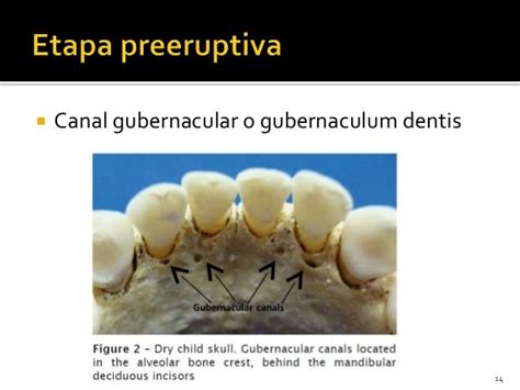 Erupción dentaria