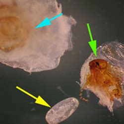 4: The Chigoe Flea - 5 Parasites That Breed On and In Your Skin ...