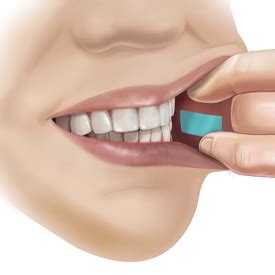 Innovative Drug Delivery Using The PharmFilm® Drug Delivery Platform | Aquestive Therapeutics