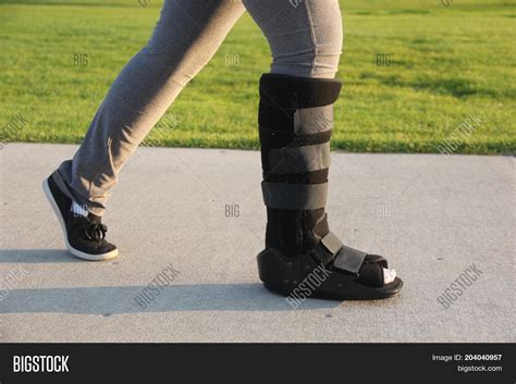 Broken Ankle Walking Cast