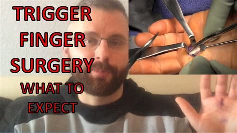 Trigger Finger Surgery - What To Expect | Trigger Finger / Trigger Thumb Release Surgery – What ...