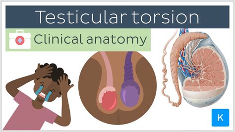 Testicular Torsion Treatment