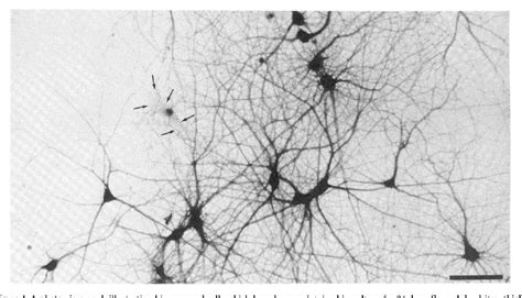 Figure 1 from An electron microscopic study of the development of axons ...