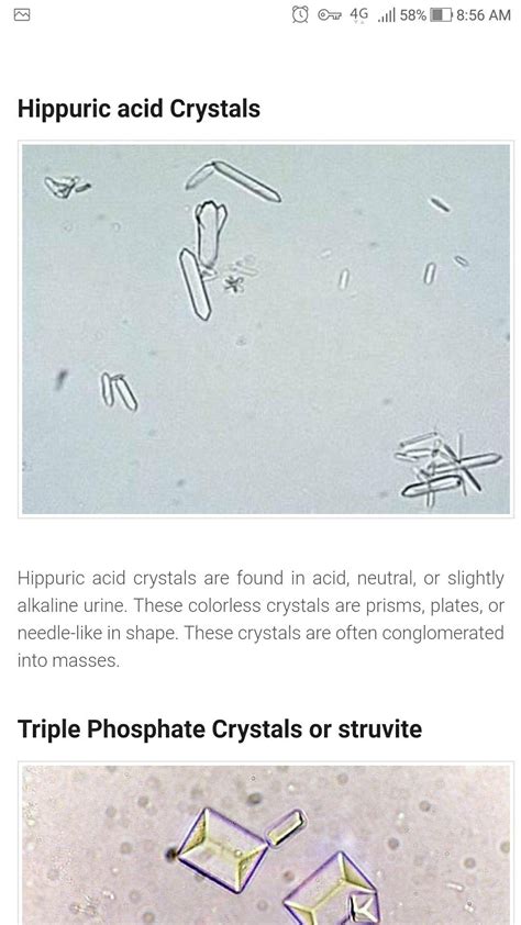 Hippuric acid | Medical laboratory scientist, Medical laboratory ...