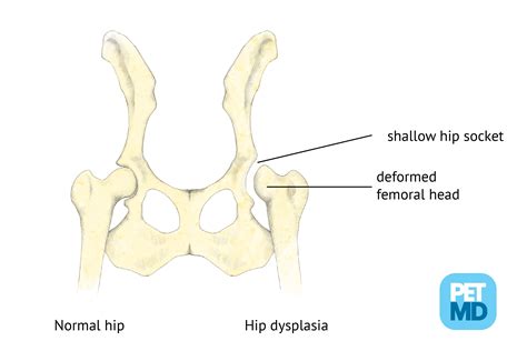 Hip Dysplasia in Dogs: Signs, Treatment, Surgery