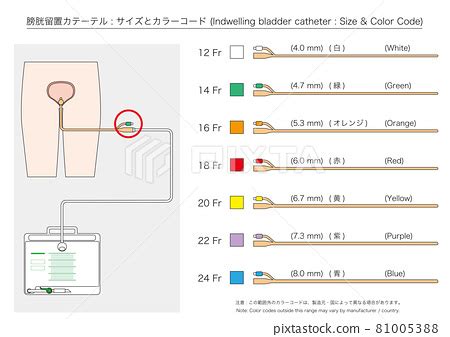 [Medical] Indwelling bladder catheter size and... - Stock Illustration [81005388] - PIXTA