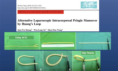 Cirbosque #SoMe4Surgery on Twitter: "Laparoscopic Pringle maneuver: intra vs extra corporeal ...