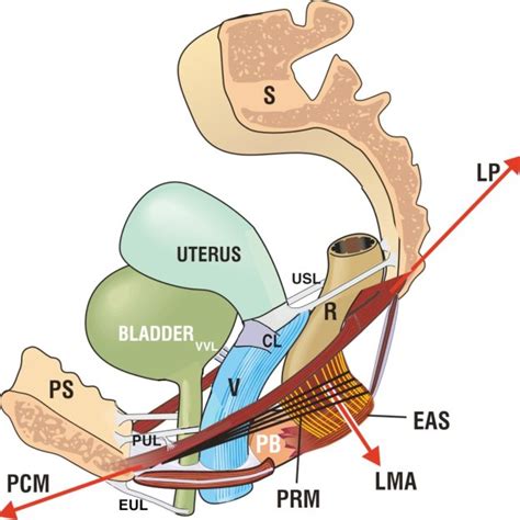 The cardinal ligament (CL) extends anteriorly to fuse with the cervical ...