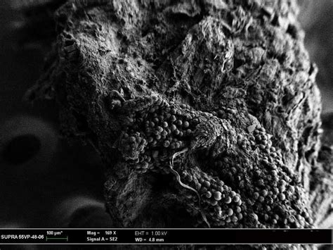 112): showing histological sections of submandibular gland, serous ...