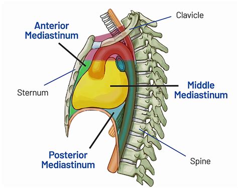 Mediastinal Tumor (Mass): Symptoms, Diagnosis and Stages | Saint John’s ...