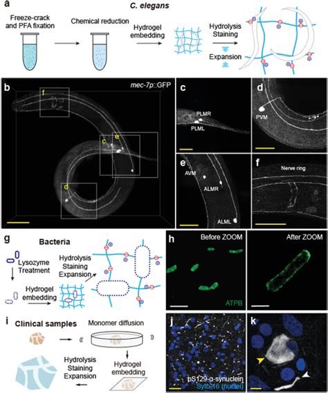 ZOOMing into diverse biological samples. a) Whole transgenic C. elegans... | Download Scientific ...