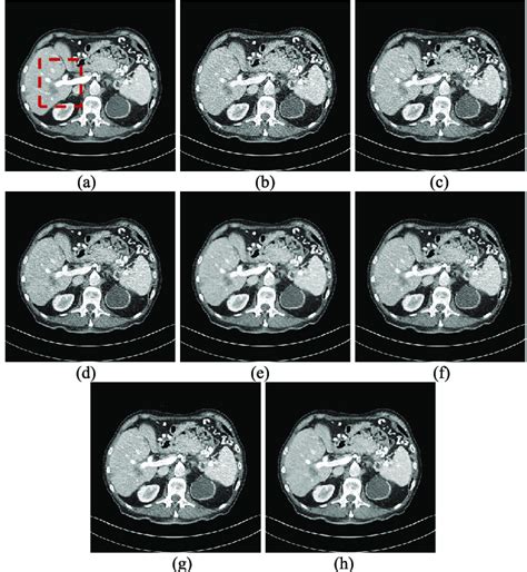 Results of an abdominal CT scan from the testing set using different... | Download Scientific ...