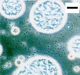 Typical structure of coacervates formed after complexation of b... | Download Scientific Diagram