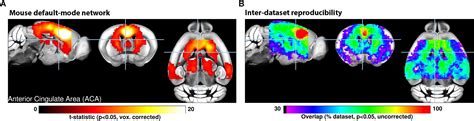 Analysis of functional mri time-series- human brain mapping - leqwerlovers