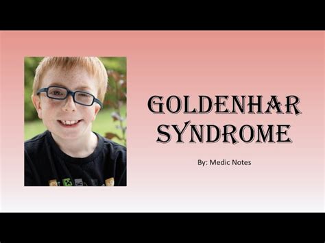 Goldenhar Syndrome Baby