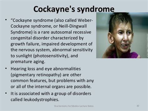 EXAMS AND ME : Cockayne Syndrome