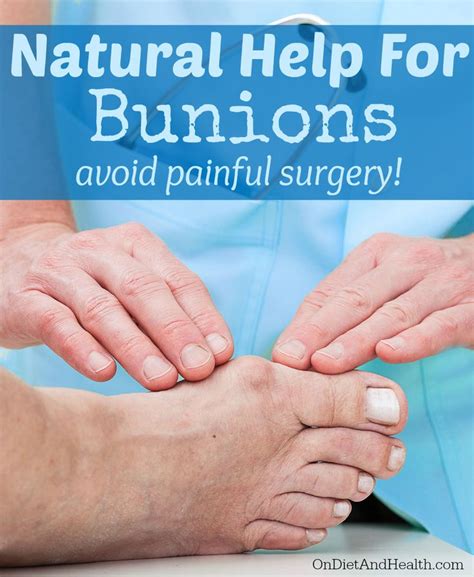 Natural help for #bunions - avoid painful surgery! OnDietAndHealth.com Back Pain Remedies ...