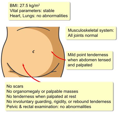 Spigelian Hernia - Interactive case study | Clinical Odyssey by Medical Joyworks, LLC