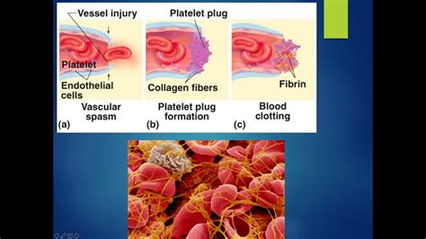 5 Stages Of Hemostasis