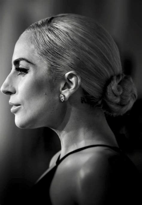 Convex Profile | Lady gaga pictures, Lady gaga nose, Lady gaga face