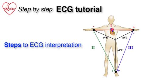 ECG Basics 1/10 - Introduction and Approach to the ECG - YouTube