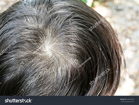 Boys Crown Head Stock Photo 620025935 | Shutterstock