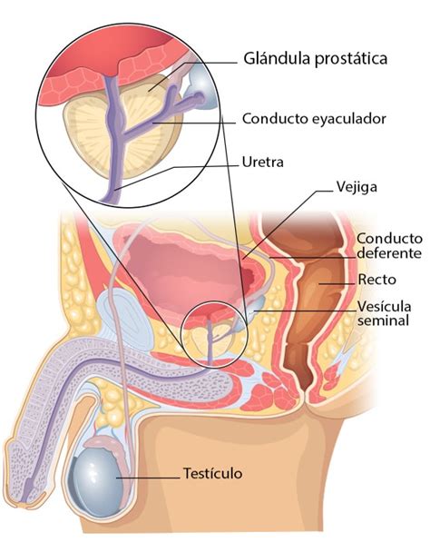 ¿Qué es el cáncer de próstata? | CDC