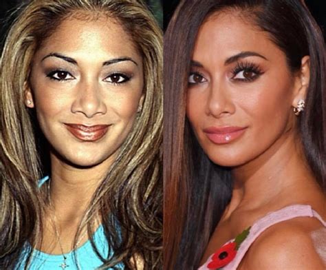 Nicole Scherzinger Nose Job Before And After Photos